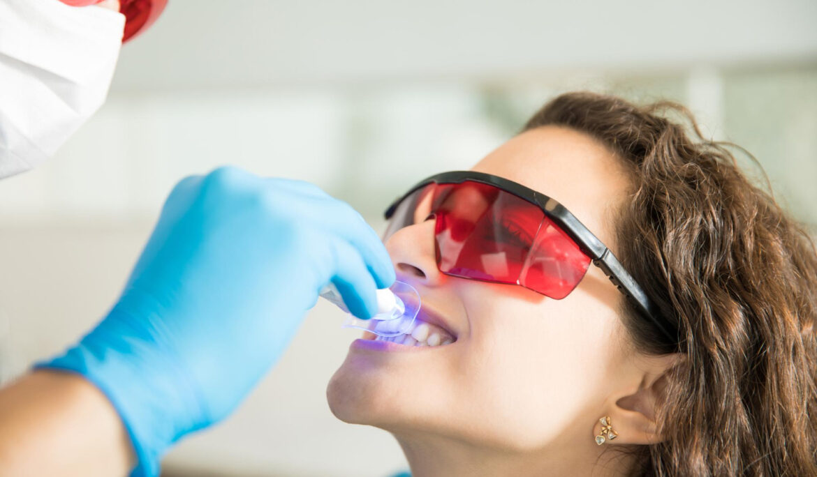 Sbiancamento dentale: come ottenere un sorriso più bianco in sicurezza Sbiancamento dentale sicuro ed efficace Studio Saldi